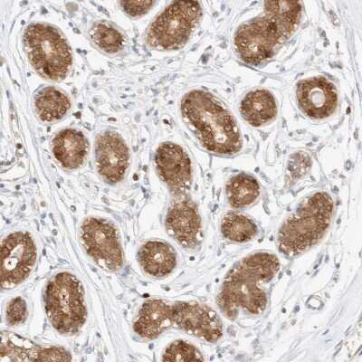 Immunohistochemistry-Paraffin: STARD10 Antibody [NBP1-84508]