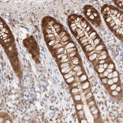 Immunohistochemistry-Paraffin: STARD10 Antibody [NBP1-84508]