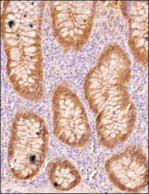 Immunohistochemistry-Paraffin: STARD10 Antibody - BSA Free [NBP2-78818]