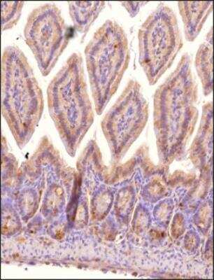 Immunohistochemistry-Paraffin: STARD10 Antibody - BSA Free [NBP2-78818]