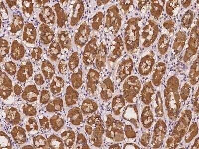 Immunohistochemistry-Paraffin: STARD10 Antibody [NBP2-98108]