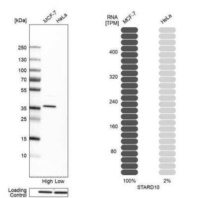 Western Blot: STARD10 Antibody [NBP1-84508]