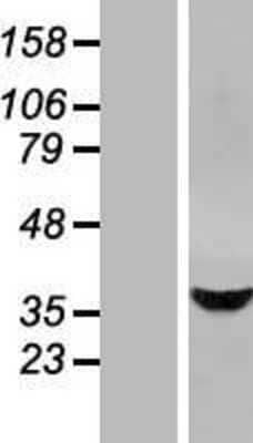 Western Blot: STARD10 Overexpression Lysate [NBL1-16517]