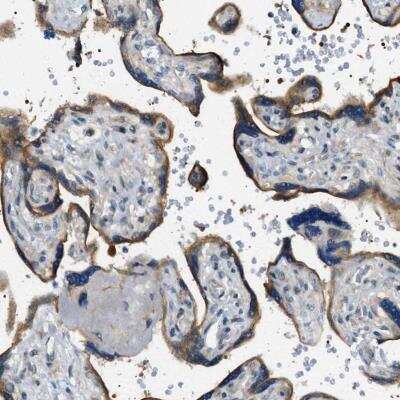 Immunohistochemistry: STARD13 Antibody [NBP1-94141]