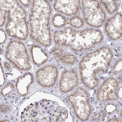 Immunohistochemistry: STARD13 Antibody [NBP2-49292]