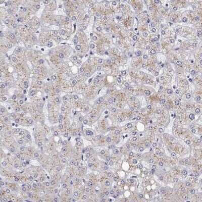 Immunohistochemistry-Paraffin: STARD13 Antibody [NBP2-49292]