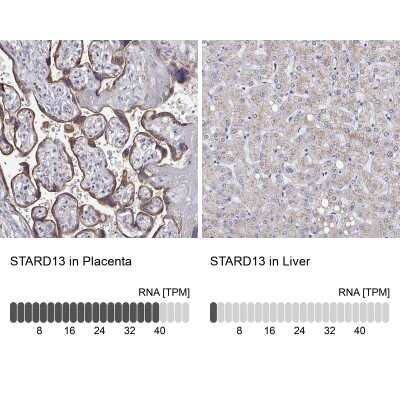 Immunohistochemistry-Paraffin: STARD13 Antibody [NBP2-49292]