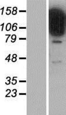 Western Blot: STARD13 Overexpression Lysate [NBP2-04997]