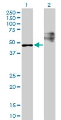 Western Blot: STARD3 Antibody (1D1) [H00010948-M01]