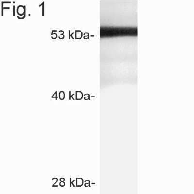 Western Blot: STARD3 Antibody [NB300-599]