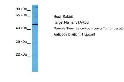 Western Blot: STARD3 Antibody [NBP2-86834]