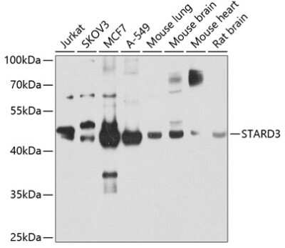 Western Blot: STARD3 AntibodyBSA Free [NBP2-94159]