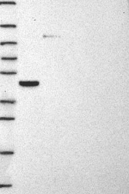 Western Blot: STARD3 Antibody [NBP3-17314]