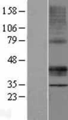 Western Blot: STARD3 Overexpression Lysate [NBP2-07577]