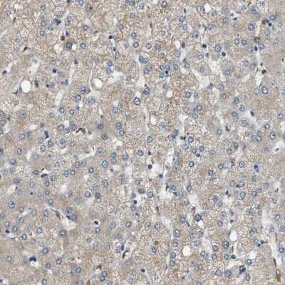 Immunohistochemistry-Paraffin: STARD3NL Antibody [NBP1-93527]