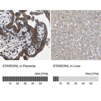 Immunohistochemistry-Paraffin: STARD3NL Antibody [NBP1-93527]