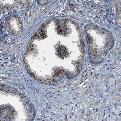 Immunohistochemistry-Paraffin: STARD3NL Antibody [NBP1-93527]