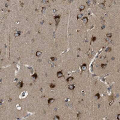 Immunohistochemistry-Paraffin: STARD3NL Antibody [NBP1-93527]