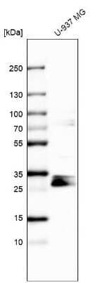 Western Blot: STARD3NL Antibody [NBP1-93527]