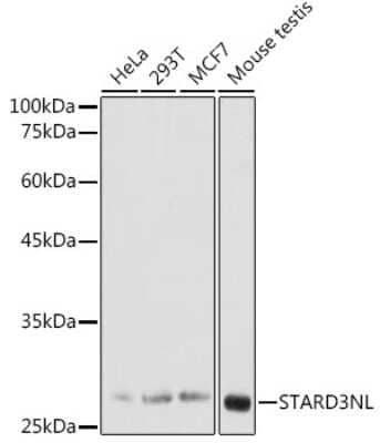 Western Blot: STARD3NL AntibodyAzide and BSA Free [NBP2-94673]