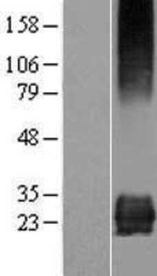 Western Blot: STARD3NL Overexpression Lysate [NBP2-06089]