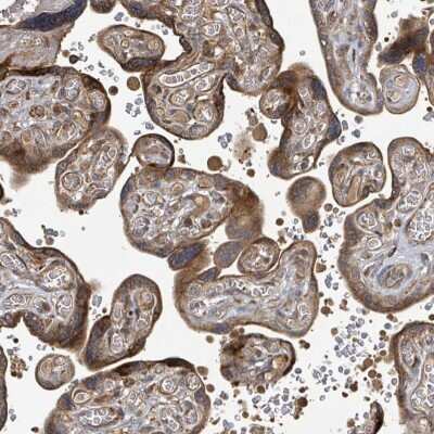 Immunohistochemistry-Paraffin: STARD4 Antibody [NBP2-30541]