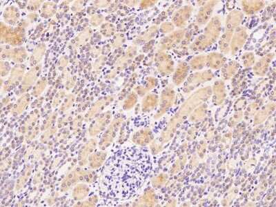 Immunohistochemistry-Paraffin: STARD4 Antibody [NBP2-99102]