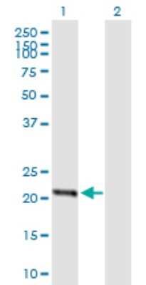 Western Blot: STARD4 Antibody [H00134429-B01P]