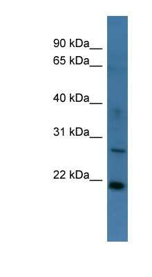 Western Blot: STARD4 Antibody [NBP1-68978]