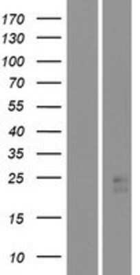 Western Blot: STARD4 Overexpression Lysate [NBP2-05588]