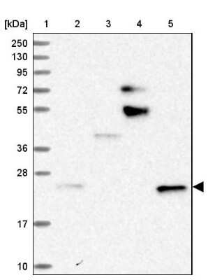 Western Blot: STARD5 Antibody [NBP1-92448]