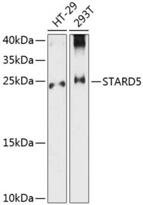 Western Blot: STARD5 AntibodyAzide and BSA Free [NBP2-94749]