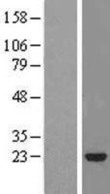 Western Blot: STARD5 Overexpression Lysate [NBL1-16520]