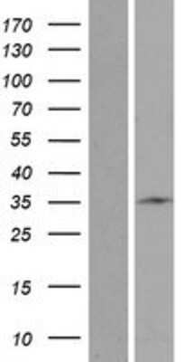 Western Blot: STARD6 Overexpression Lysate [NBP2-05592]