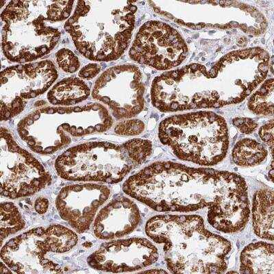 Immunohistochemistry-Paraffin: STARD8 Antibody [NBP2-32567]