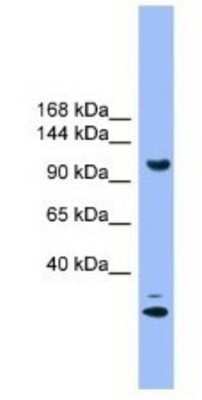 Western Blot: STARD8 Antibody [NBP1-69097]