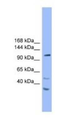 Western Blot: STARD8 Antibody [NBP1-69098]