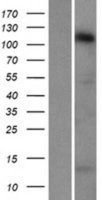 Western Blot: STARD8 Overexpression Lysate [NBP2-07290]