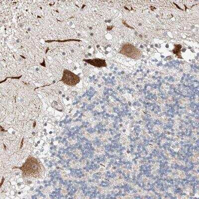 Immunohistochemistry-Paraffin: STARD9 Antibody [NBP1-82917]