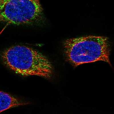 Immunocytochemistry/ Immunofluorescence: START domain containing 7 Antibody [NBP2-57423]