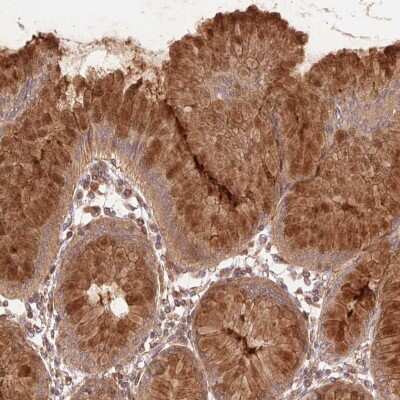 Immunohistochemistry: START domain containing 7 Antibody [NBP2-49433]