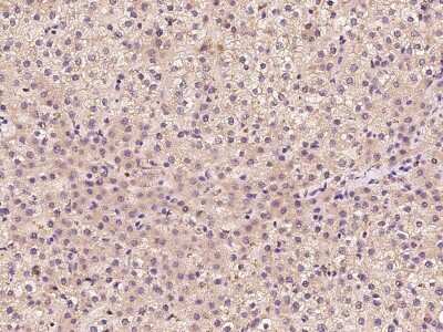 Immunohistochemistry-Paraffin: START domain containing 7 Antibody [NBP2-97964]