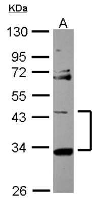 Western Blot: START domain containing 7 Antibody [NBP2-20502]