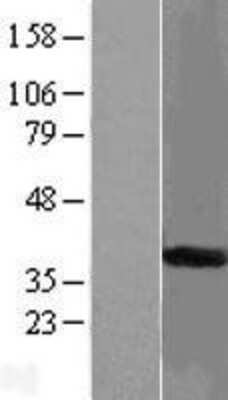 Western Blot: START domain containing 7 Overexpression Lysate [NBL1-16522]