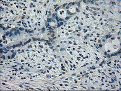 Immunohistochemistry-Paraffin: STAT1 Antibody (OTI15H3) [NBP1-48013]