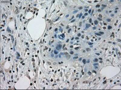 Immunohistochemistry-Paraffin: STAT1 Antibody (OTI15H3) [NBP1-48013]