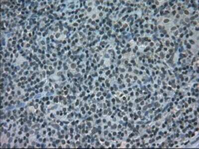 Immunohistochemistry-Paraffin: STAT1 Antibody (OTI15H3) [NBP1-48013]