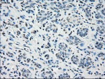 Immunohistochemistry-Paraffin: STAT1 Antibody (OTI4H9) [NBP1-48011]