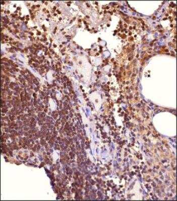 Immunohistochemistry-Paraffin: STAT1 Antibody [NB100-56314]