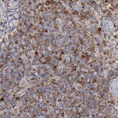 Immunohistochemistry-Paraffin: STAT1 Antibody [NBP1-81578]